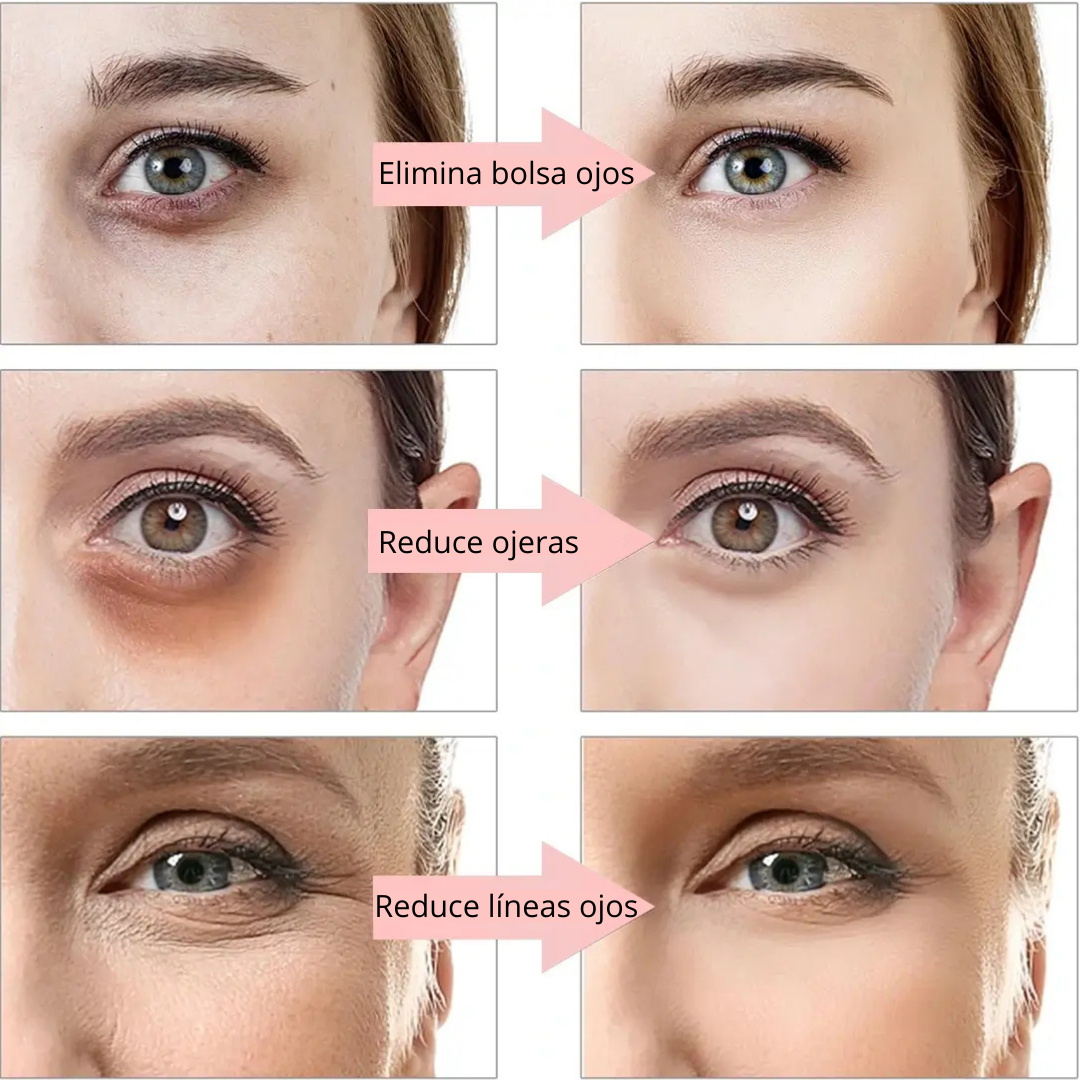Lumina Ojos Revitalizer®