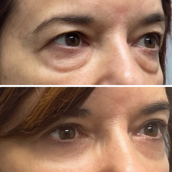Parche Hidrogel Ojos Radiantes