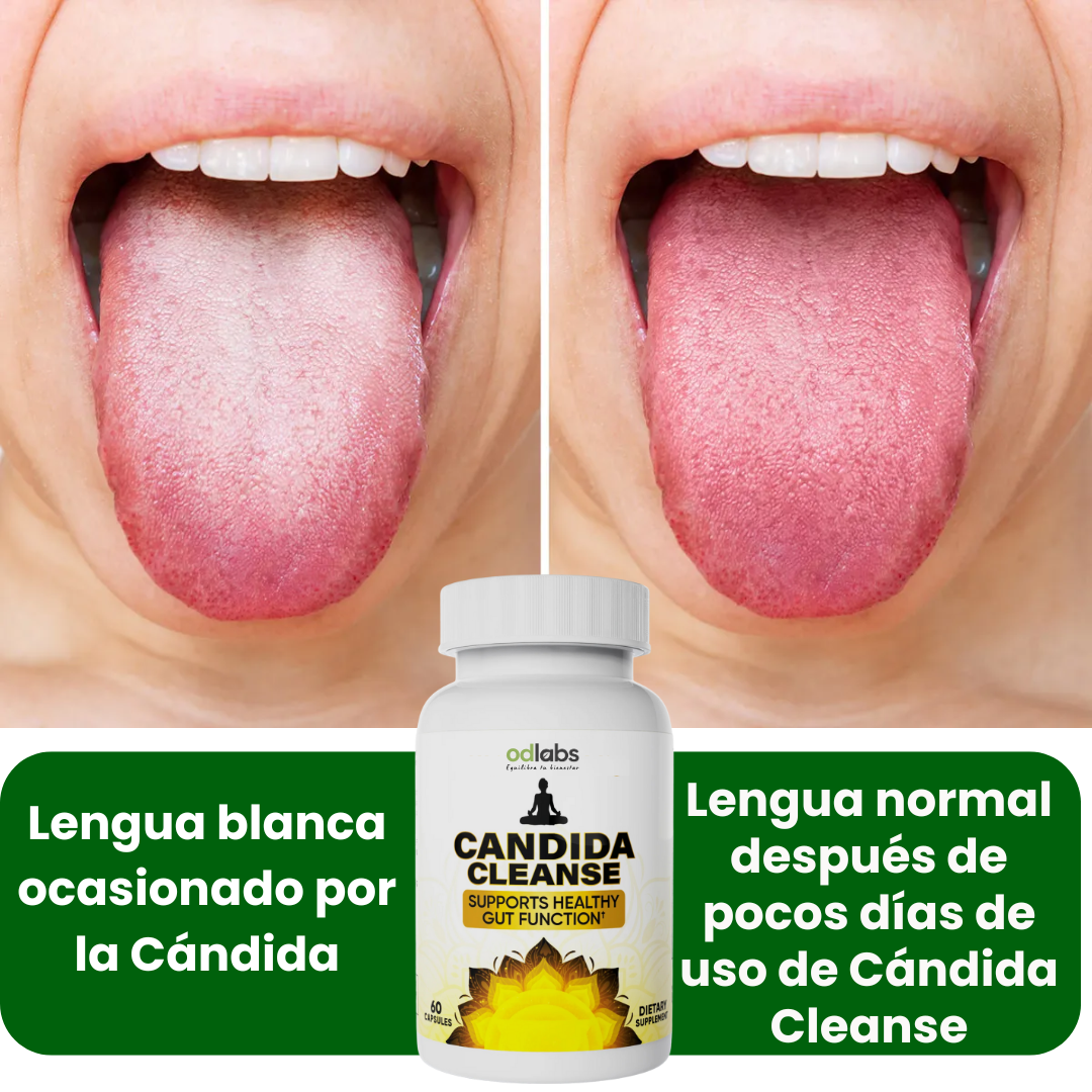 Cándida Cleanse - Ayuda a limpiar la lengua blanca