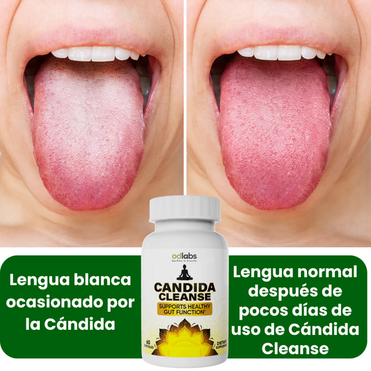 Cándida Cleanse - Ayuda a limpiar la lengua blanca