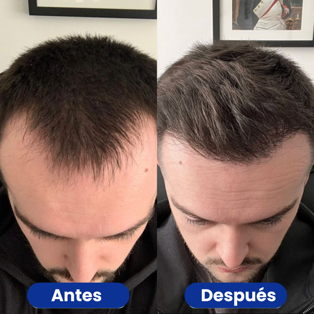 Capilène® - Sérum Crecimiento del Cabello