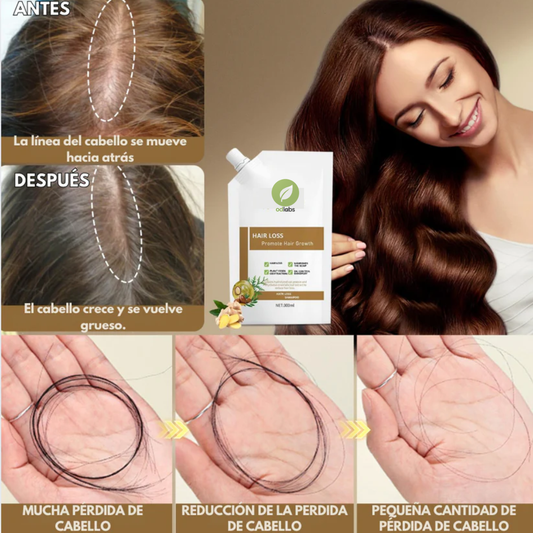 Shampoo Anticaída & Reactivador Folículos