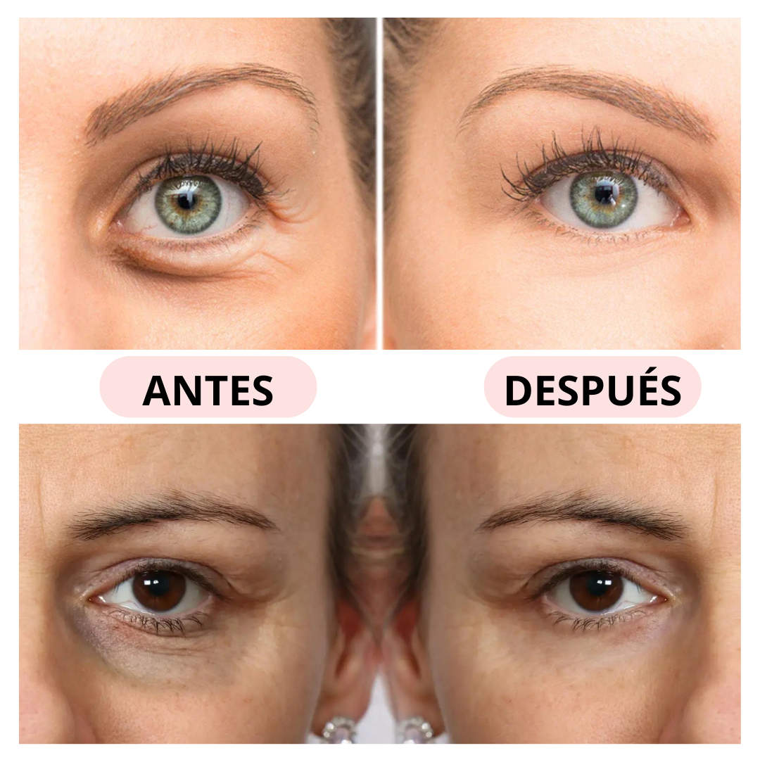 Lumina Ojos Revitalizer®