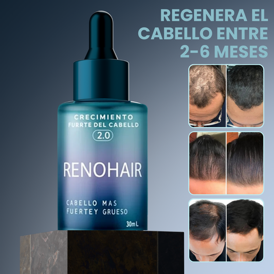 Renohair® – Suero Anticaída y Crecimiento Capilar