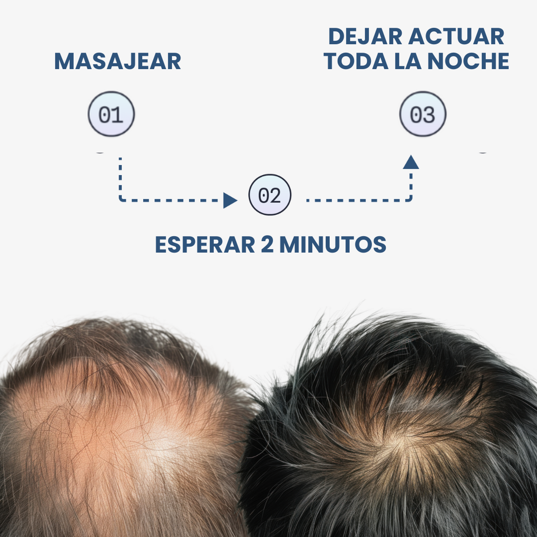 Renohair® – Suero Anticaída y Crecimiento Capilar