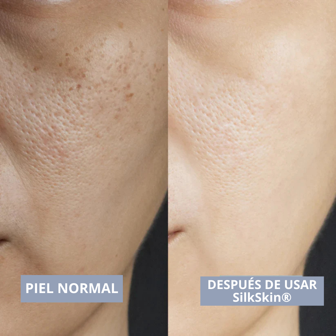 SilkSkin® - CCCream