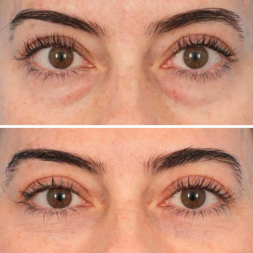 Parches Colágeno & Péptidos para Ojos