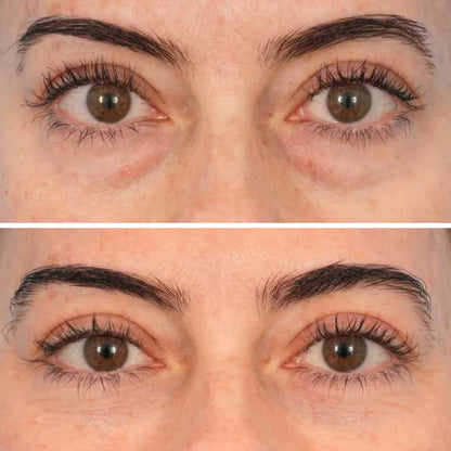 Parches Colágeno & Péptidos para Ojos