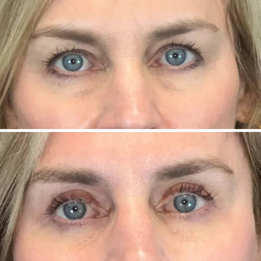 Parches Colágeno & Péptidos para Ojos