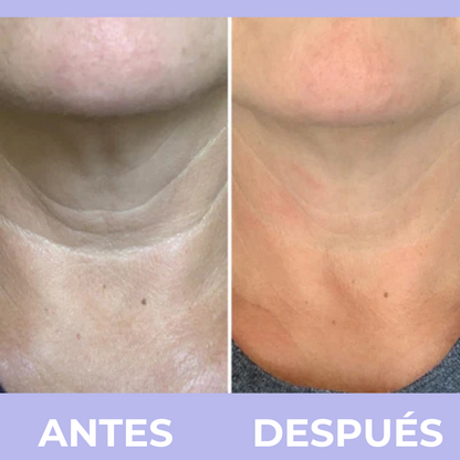 PURA Skincare™  Crema para el Cuello