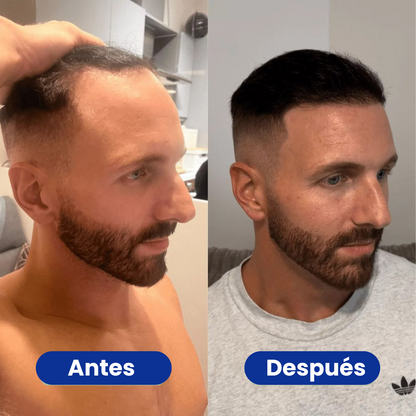 Capilène® - Sérum Crecimiento del Cabello