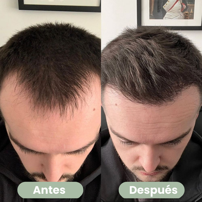 Capilène - Sérum Crecimiento Cabello