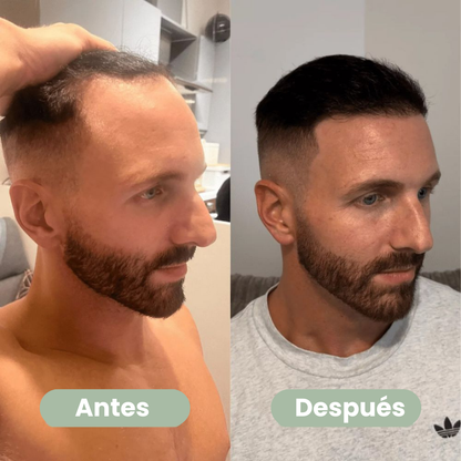 Capilène - Sérum Crecimiento Cabello