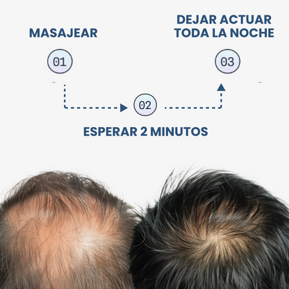 Renohair® – Suero Anticaída y Crecimiento Capilar