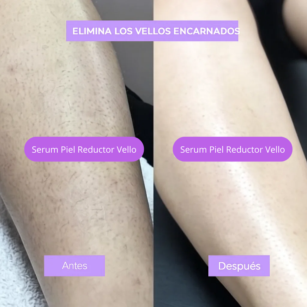 Nuevo Sérum Reductor Vello Facial