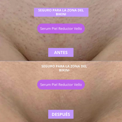 Nuevo Sérum Reductor Vello Facial