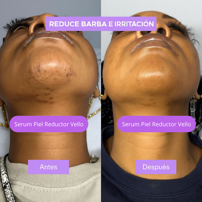 Nuevo Sérum Reductor Vello Facial