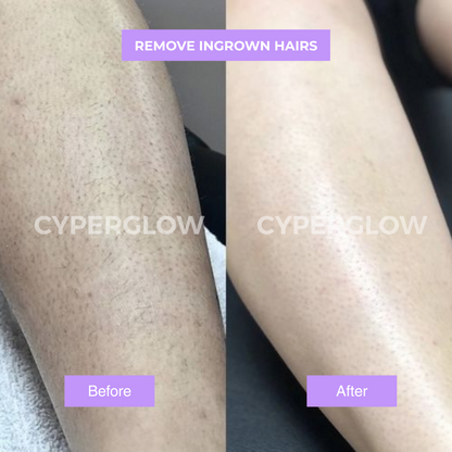Nuevo Sérum Reductor Vello Facial